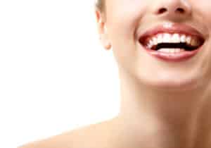 Woman flashes an amazing smile with white teeth.