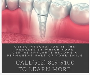 Austin Implant Dentistry 1 300x251 1
