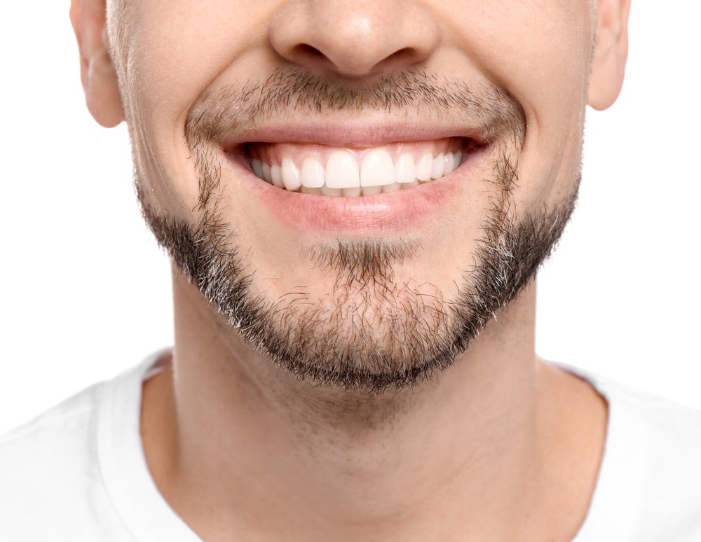 Man smiles widely to show bright white teeth thanks to teeth whitening.