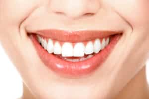 Close-up of woman's beautiful white teeth after veneer treatment.